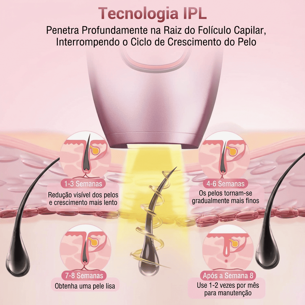Depilador IPL Laser™