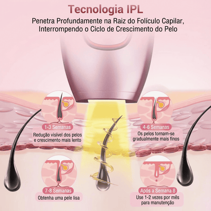 Depilador IPL Laser™