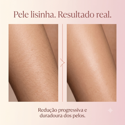 Depilador IPL Laser™