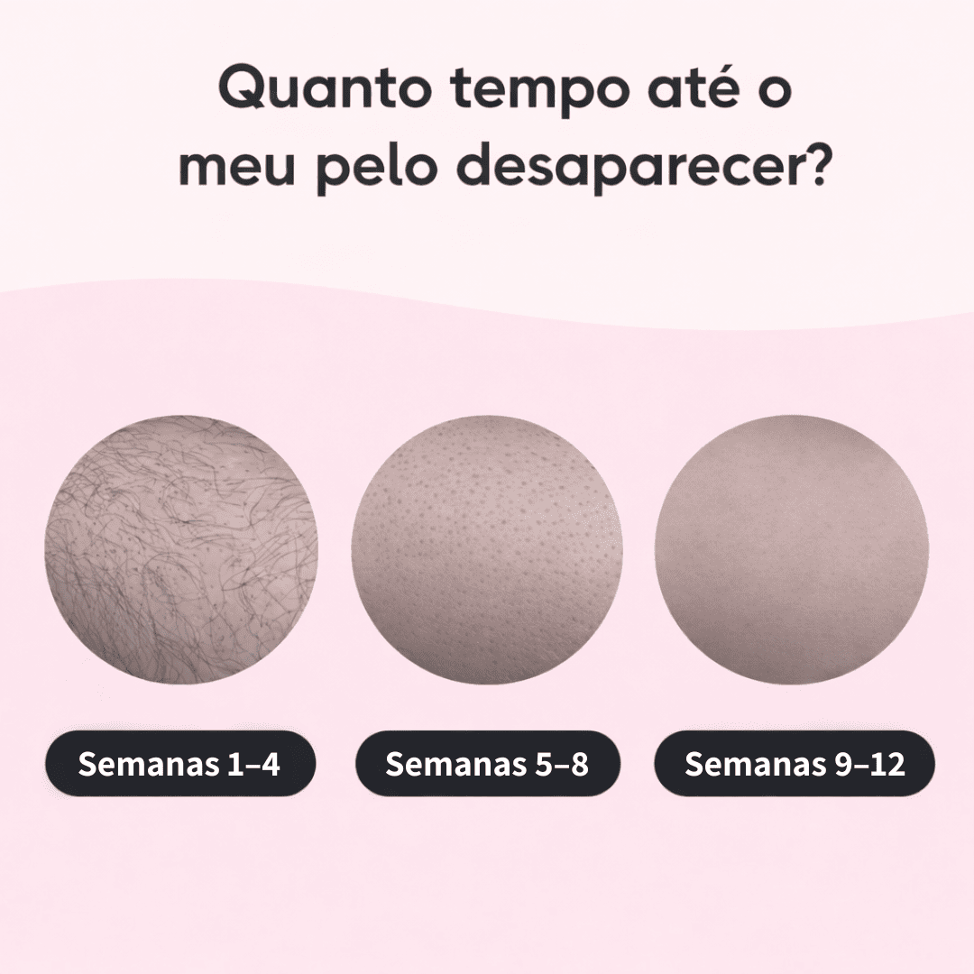 Depilador IPL Laser™