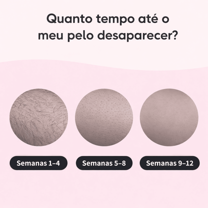 Depilador IPL Laser™